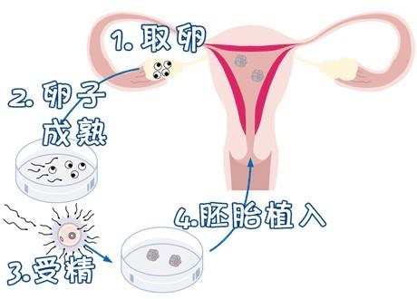 42岁二胎妈妈